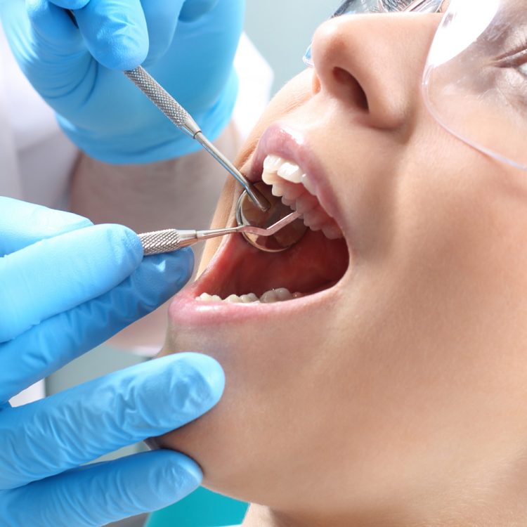 A dentist examining a patient's upper teeth with a mirror and probe